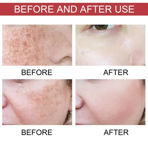 Fade & Glow – Dark Spot Correcting Moisture Serum